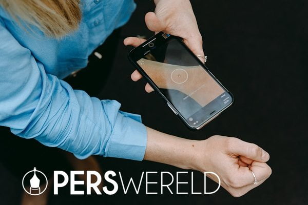 Samenwerking tussen UV-Fashions en SkinVision